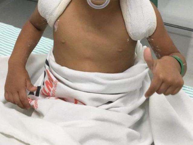 Ap&oacute;s se queixar de dores em Emei, m&atilde;e descobre que filha quebrou a clav&iacute;cula