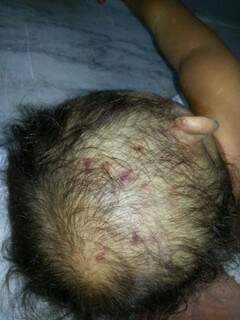 Criança apresentava hematomas na cabeça provocadas pelas agressões. 