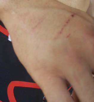  Adolescente &eacute; agredido por grupo de jovens em frente &agrave; pr&oacute;pria casa