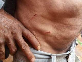 Caseiro mostra ferimentos provocados por índios durante invasão (Foto: Osvaldo Duarte/Dourados News)