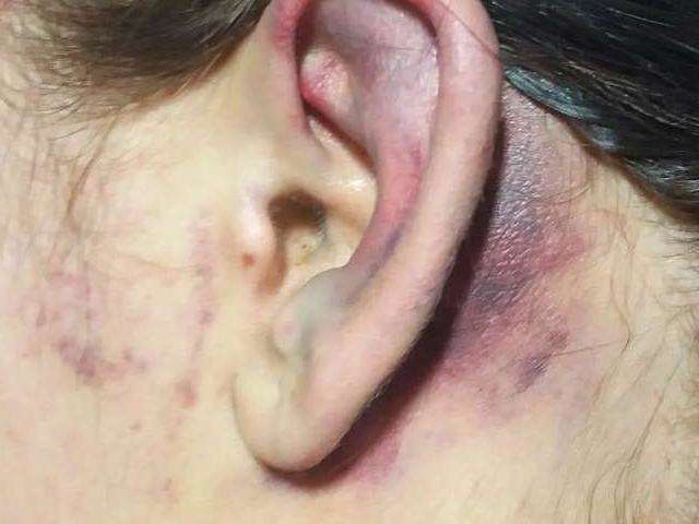 Homem n&atilde;o aceita fim de namoro, invade casa da ex e tortura v&iacute;tima por 4 horas