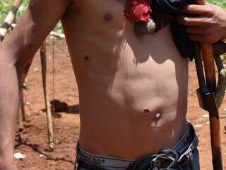 Indígena atacado mostra os ferimentos (Foto: Divulgação)
