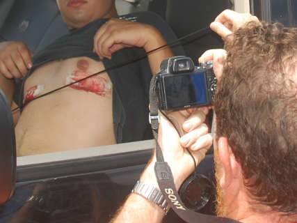  Rapaz que atropelou policial civil diz que foi atingido por tiro de raspão