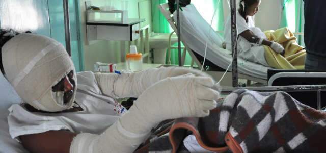  Pol&iacute;cia Civil repassa investiga&ccedil;&atilde;o de atentado a &ocirc;nibus &agrave; Pol&iacute;cia Federal