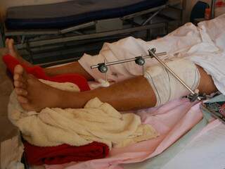 Renildo aguarda cirurgia no joelho (Fotos: Mariana Lopes)