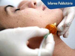 Carboxiterapia faz aplicação de gás carbônico na pele. (Foto: Fernando Antunes)