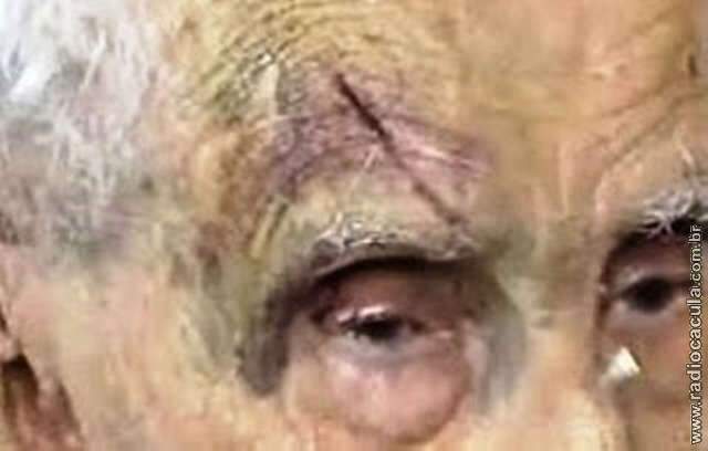  Idoso de 81 anos &eacute; espancado e roubado pelo neto em Tr&ecirc;s Lagoas 