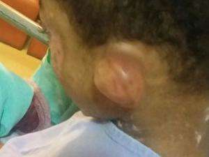 Vítima de socos e queimaduras, menino segue internado em hospital 