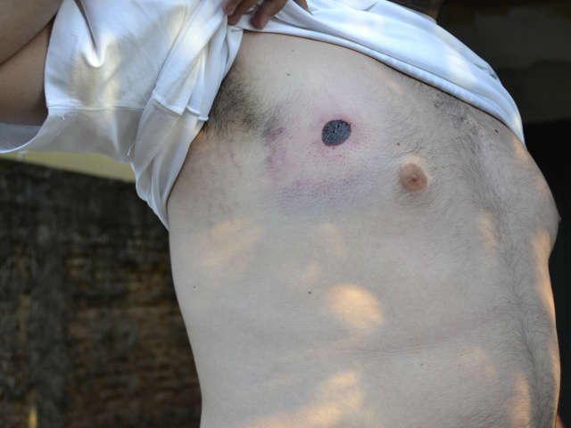  Com marca de bala de borracha no corpo, torcedor diz que Cigcoe foi truculenta