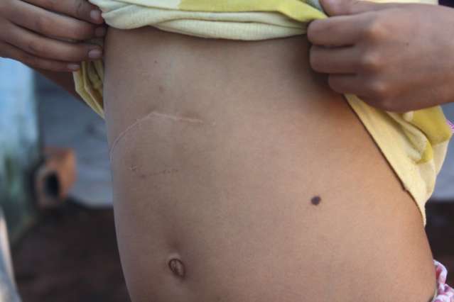 Com cirurgia marcada, m&atilde;e pede ajuda para transplante de menina