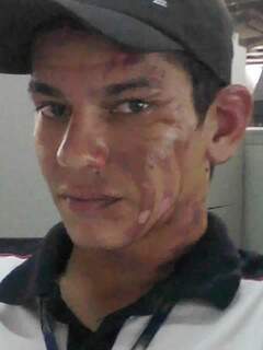 Rapaz foi ferido no rosto. (Foto: Arquivo Pessoal)