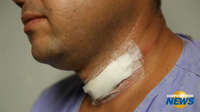 Homem que teve pesco&ccedil;o cortado por cerol vai &agrave; pol&iacute;cia