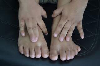 Guilherme nasceu com dedos da mão direita grudados e seis dedos no pé esquerdo (Foto: Pedro Peralta)