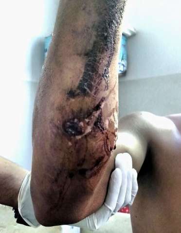 PF investiga ataque a &iacute;ndios, mas tens&atilde;o continua em &aacute;rea de conflito