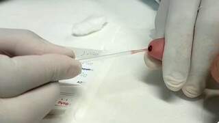 Hospital faz testes gratuitos em comemoração ao dia mundial contra hepatite