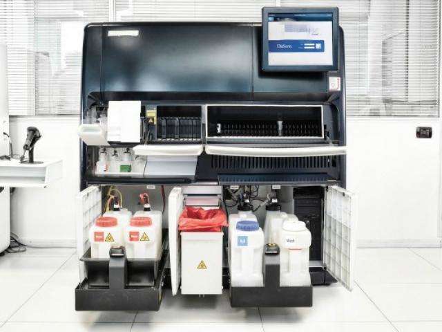 Nova m&aacute;quina em laborat&oacute;rio central pode fazer 30 mil exames por m&ecirc;s