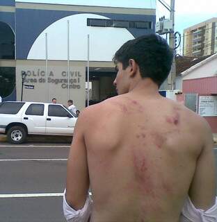 O rapaz mostra sinais de espancamento sofrido em boate localizada perto da Feira Central. (Fotos: Divulgação).