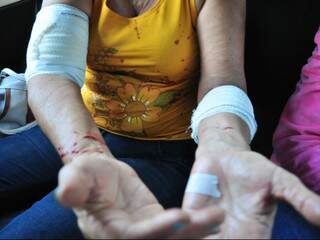 Ramona Ilza da Silva Saravy, de 61 anos, foi atacada nos dois braços (Foto: João Garrigó)