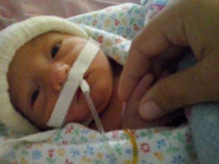 Hospital tenta transferir beb&ecirc; sem intestino para centro especializado