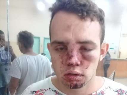 Com rosto ferido, estudante denuncia truculência de seguranças de boate 