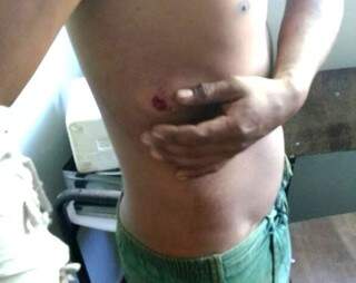 Adolescente indígena ficou com bala alojada no corpo (Foto: Divulgação/Cimi)