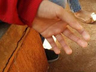 Adolescente fez foto da mão do irmão, logo após incidente (Foto: arquivo familiar)