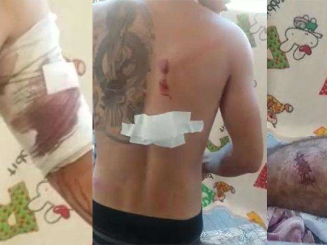 V&iacute;deo mostra detentos feridos ap&oacute;s confronto com policiais do Choque