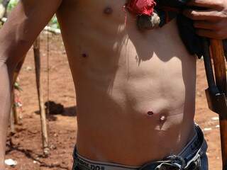 Adolescente tem marcas de ferimento, após ataque a acampamento indígena no Sul do Estado. (Foto: Divulgação MPF)