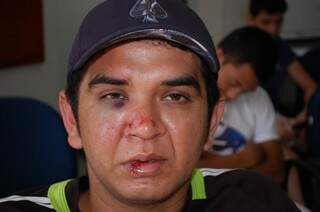 Ederson diz ter sido agredido por um guarda municipal na madrugada. (Foto: Pedro Peralta)