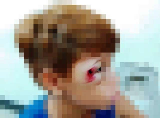 Menino de 10 anos &eacute; agredido com peda&ccedil;o de madeira por rapaz