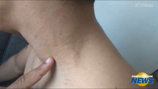 &ldquo;Fui imprudente&rdquo;, diz guarda municipal agredido por usu&aacute;rios de drogas