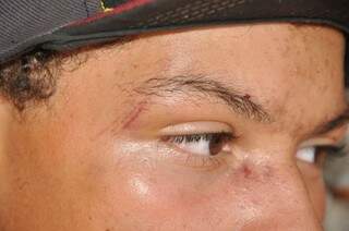 Menino ficou traumatizado após ser agredido por oito colegas (Foto: Marcelo Calazans)