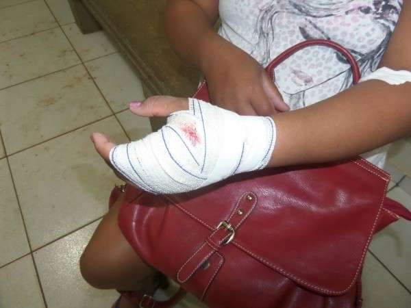 Ap&oacute;s desentendimento, marido fratura m&atilde;o da esposa com golpes de martelo