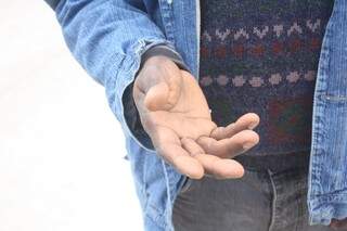 Daniel mostra a mão, negra, e mantém versão de que foi discriminado (Foto: Marcos Ermínio/Arquivo)