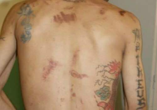 Preso que denunciou espancamento &eacute; transferido de pres&iacute;dio