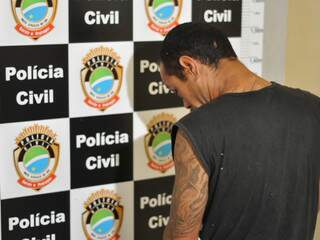 Edson Salinas ficou com escoriações pelo corpo ao ser agredido quando tentava roubar uma moto. (Foto: Marlon Ganassin)