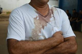Comerciante com marcas de sangue na camiseta; ele conta que foi agredido por assaltantes (Foto Bianca Bianchi)