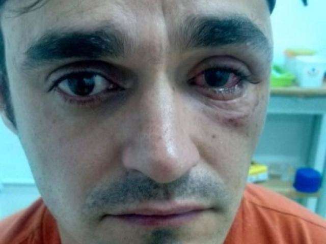 Motociclista teme perder vis&atilde;o de um olho ap&oacute;s ser atingido por ovo na rua