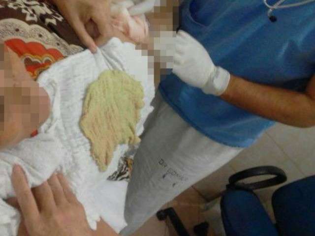 Um m&ecirc;s ap&oacute;s cirurgia, compressa &eacute; encontrada dentro do abd&ocirc;men de mulher