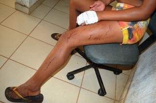 Mulher foi ferida com um corte na mão e golpes de cinto (Foto: Alisson Silva/Edição MS)