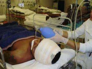 Santa Casa diz que vai instalar aparelhos e acabar com &ldquo;respirador manual&rdquo;