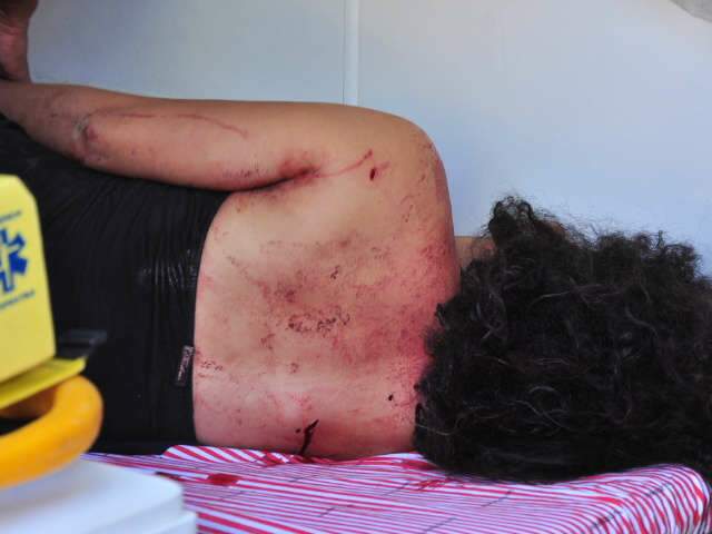  Jovem de 19 anos &eacute; ferida por duas facadas ap&oacute;s discuss&atilde;o no Itamarac&aacute;