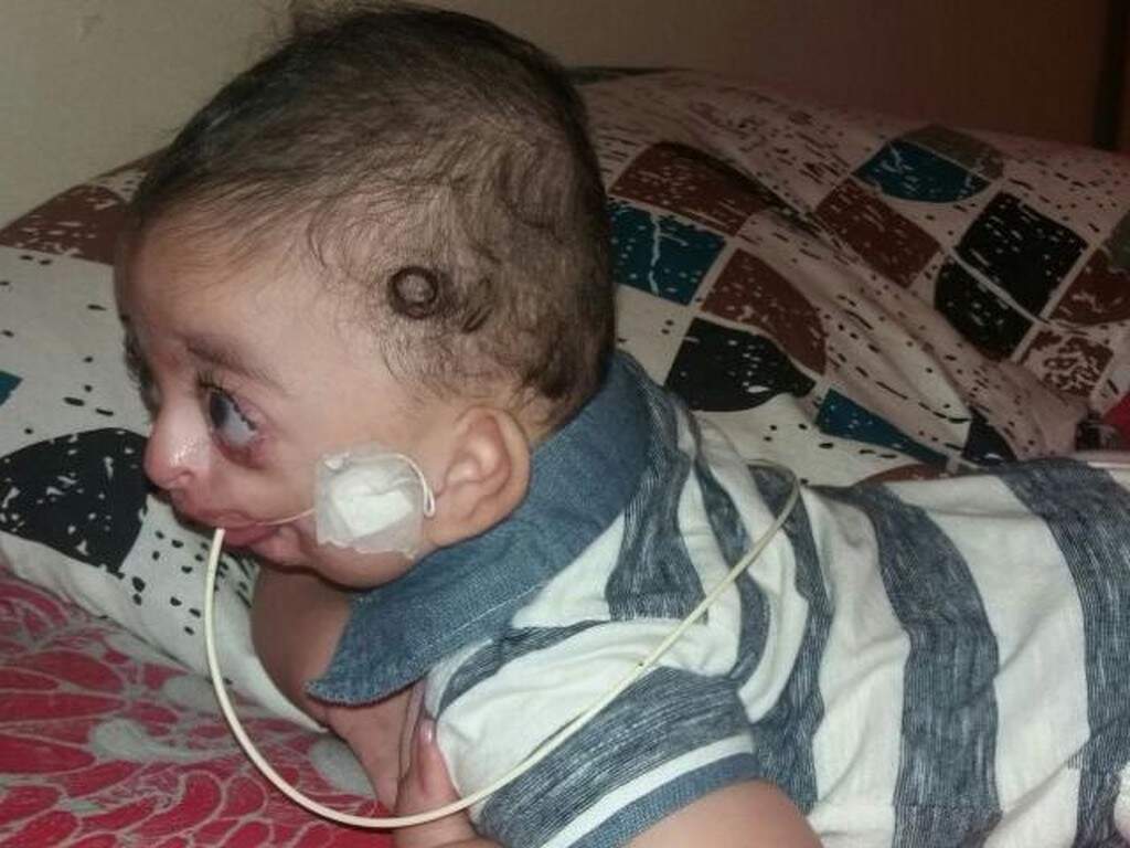 Rapel solidário vai ajudar o bebê Erik, que nasceu com malformação Capital Campo Grande News Rapel solidário vai ajudar o bebê Erik, que nasceu com malformação Capital Campo Grande News