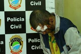 Diego cortou o rosto ao tentar fugir da polícia (Foto: André Bittar) 