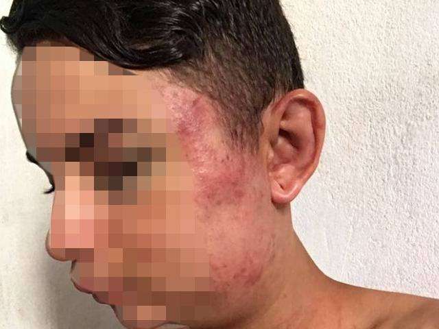 Adolescente &eacute; espancado por grupo de 5 jovens e celular some