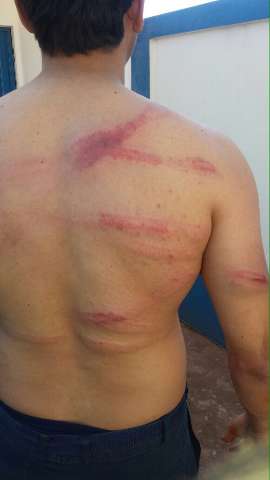 &Iacute;ndios agrediram e jogaram gasolina em policiais ref&eacute;ns, dizem bombeiros