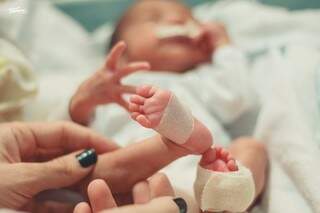 O pezinho do bebê Rafael que nasceu prematuro (Foto: Bia Terra Fotografia)