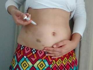 Aplicação de injeções previne episódios de trombose e aborto (Foto: Arquivo Pessoal)
