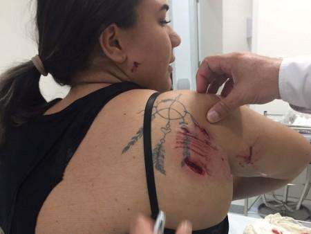V&iacute;tima de pit bull diz que n&atilde;o culpa o animal e tenta se recuperar do susto