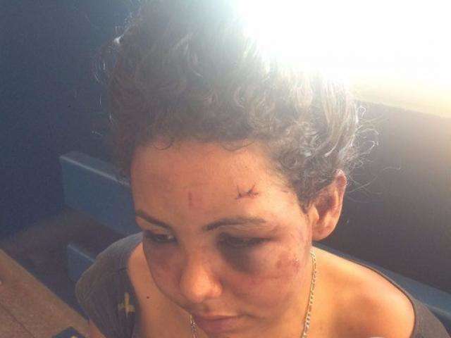 Jovem &eacute; agredida com garrafada, socos e mordidas, desmaia e acorda em canavial 